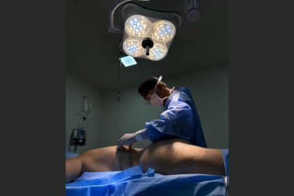 Milton Seigi Hayashi explica o uso de nanofat na enxertia de gordura regenerativa.